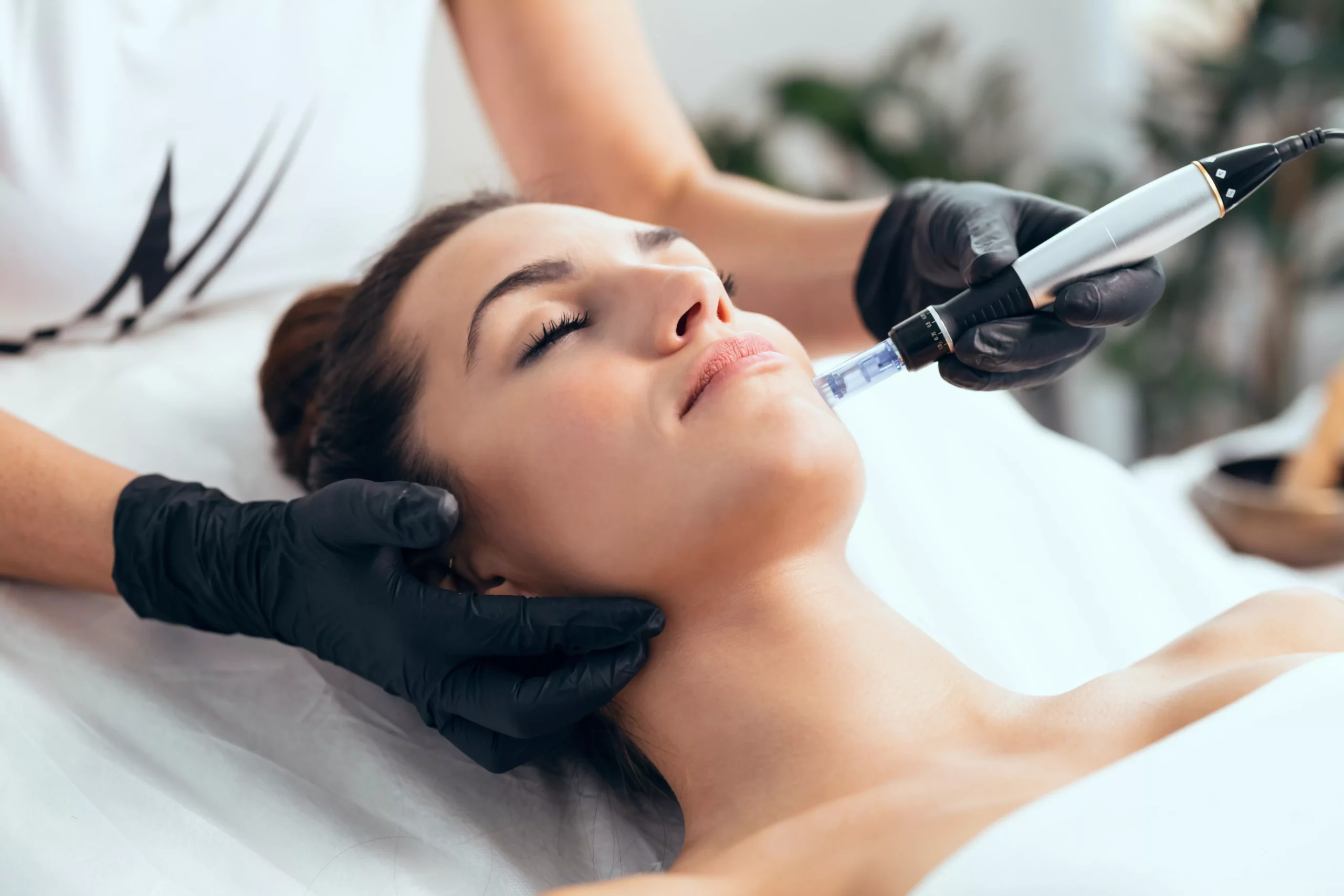 Innovative exosom Produkte für ästhetische Behandlungen bei MorySkin